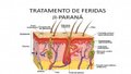 Tratamento de feridas em Ji-Paraná