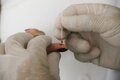 Governo de Rondônia garante diagnóstico rápido e tratamento gratuito contra malária e hepatites virais