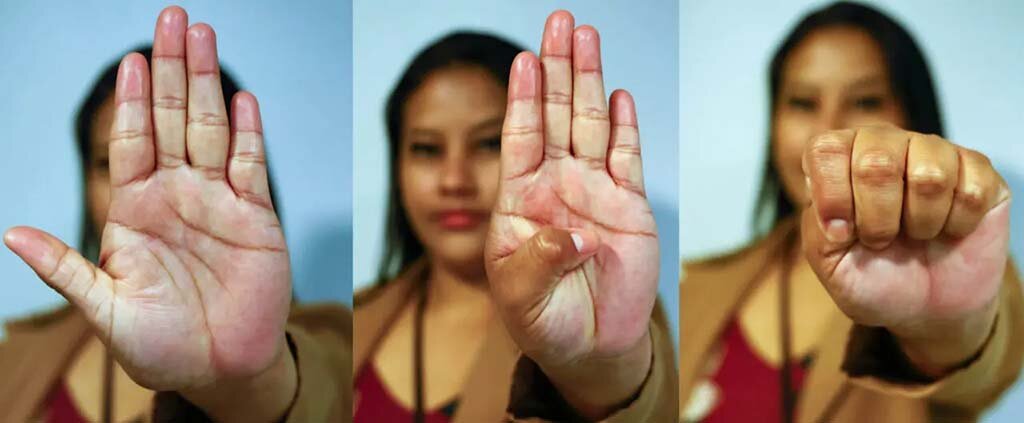 Código Universal do Sinal de Socorro consiste em apresentar a mão com a palma voltada para fora em direção à pessoa para a qual pede ajuda, dobrar o polegar para dentro e fechar os outros dedos sobre o polegar - Gente de Opinião