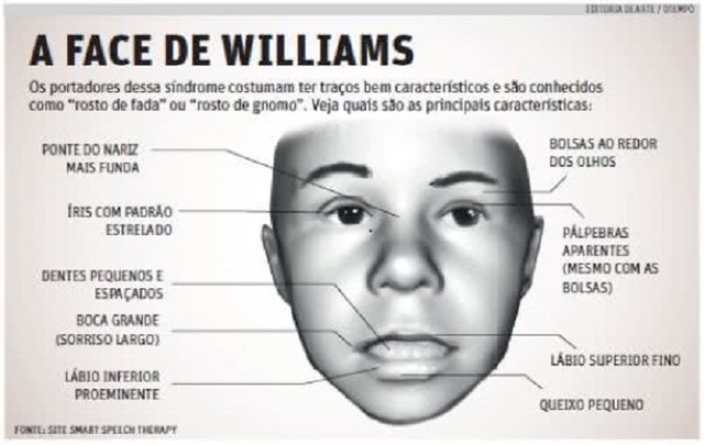 Conhece a Síndrome de Williams? - Gente de Opinião