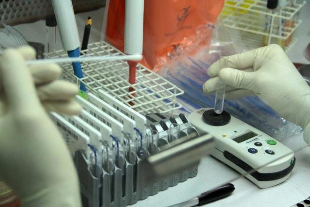 Lacen agora realiza exame para detecção do vírus H1N1 - Gente de Opinião