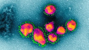 Primeiro caso suspeito de coronavírus tem resultado negativo em Rolim de Moura - Gente de Opinião