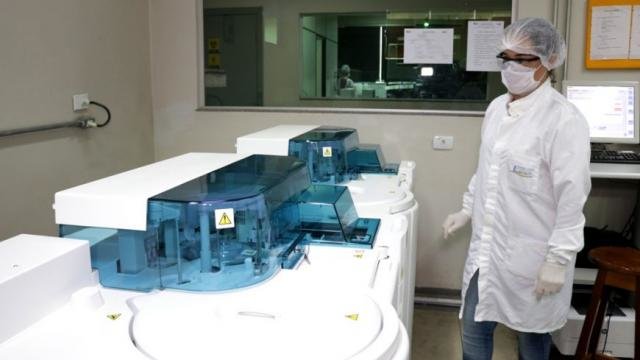 Seis novos equipamentos de automação laboratorial de alta precisão foram instalados - Gente de Opinião