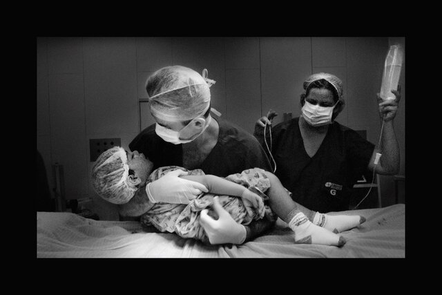 Dr. Hélio carrega nos braços uma criança que acaba de receber anestesia antes da cirurgia. A atitude diminui os traumas frente aos procedimentos cirúrgicos. Instituto do Câncer do Ceará - Fortaleza, CE) - Gente de Opinião