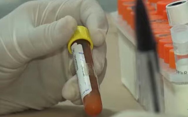 Rondônia registra três casos da variante colombiana do coronavírus - Gente de Opinião