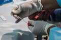 Parceria entre Agevisa e Semusa leva ações de combate às hepatites virais à Unidade de Saúde em Porto Velho