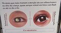 Campanha conscientiza pais sobre os riscos do retinoblastoma