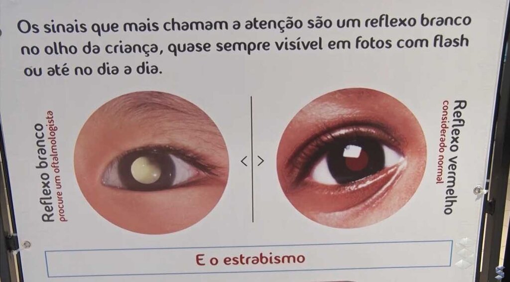 Campanha conscientiza pais sobre os riscos do retinoblastoma - Gente de Opinião