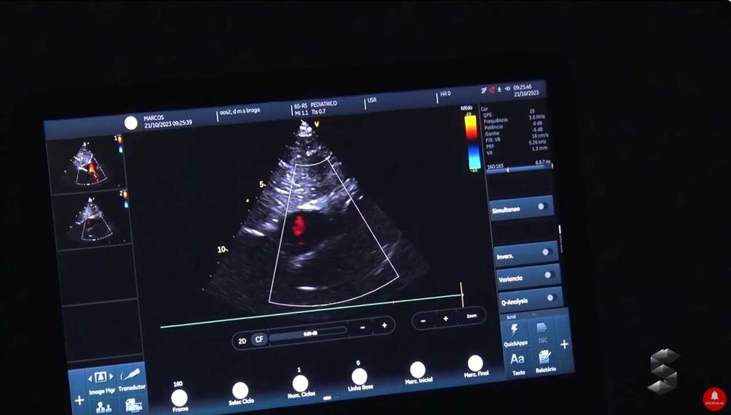 Associação Coraçãozinho faz mutirão para exames de ecocardiograma infantil - Gente de Opinião