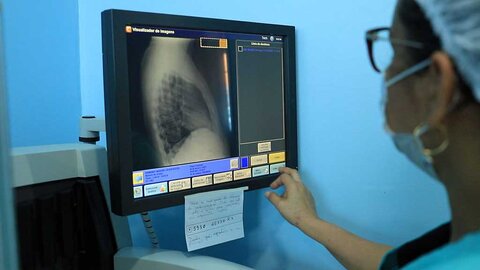 Prefeitura de Porto Velho intensifica ações de combate à tuberculose