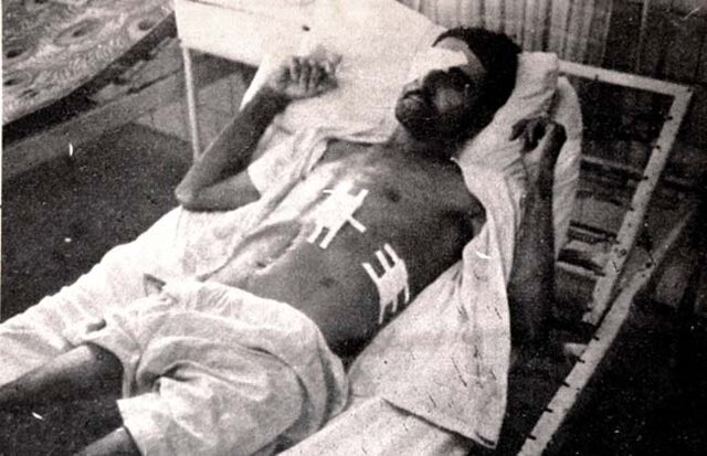 João Cecílio Perez, baleado no lote, perdia uma das vistas e ficou surdo de um ouvido (Foto Jorcêne Martínez - in memoriam) - Gente de Opinião