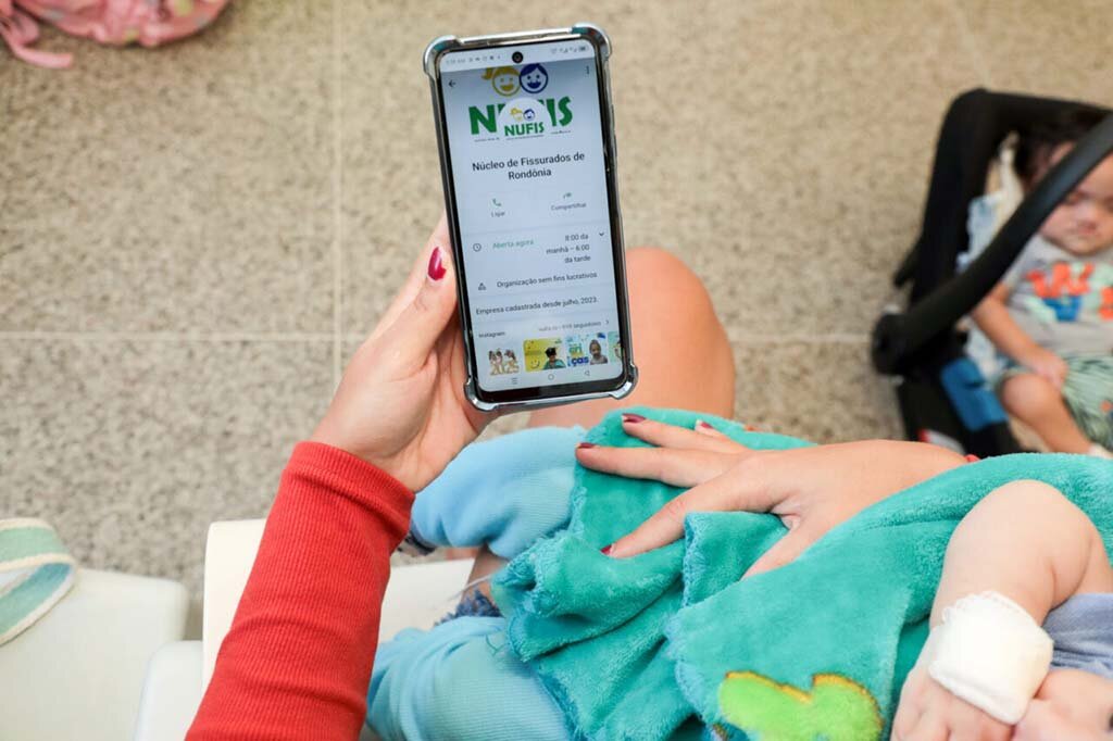 Governo de Rondônia transforma vidas no estado com mais de 24 mil consultas e 317 cirurgias de fissura labiopalatina - Gente de Opinião