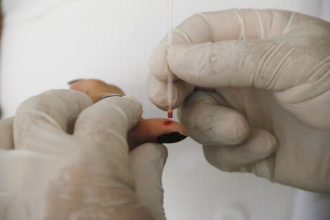 Governo de Rondônia garante diagnóstico rápido e tratamento gratuito contra malária e hepatites virais