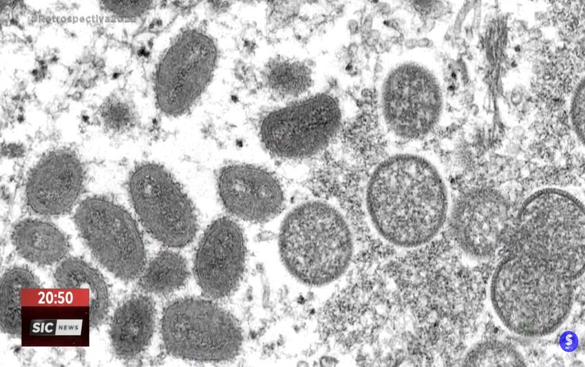 Sobe para oito o número de casos de MPOX em Rondônia