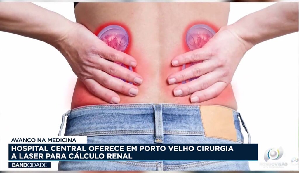 Avanço na medicina - Hospital Central oferece em Porto Velho cirurgia a laser para cálculo renal - Gente de Opinião